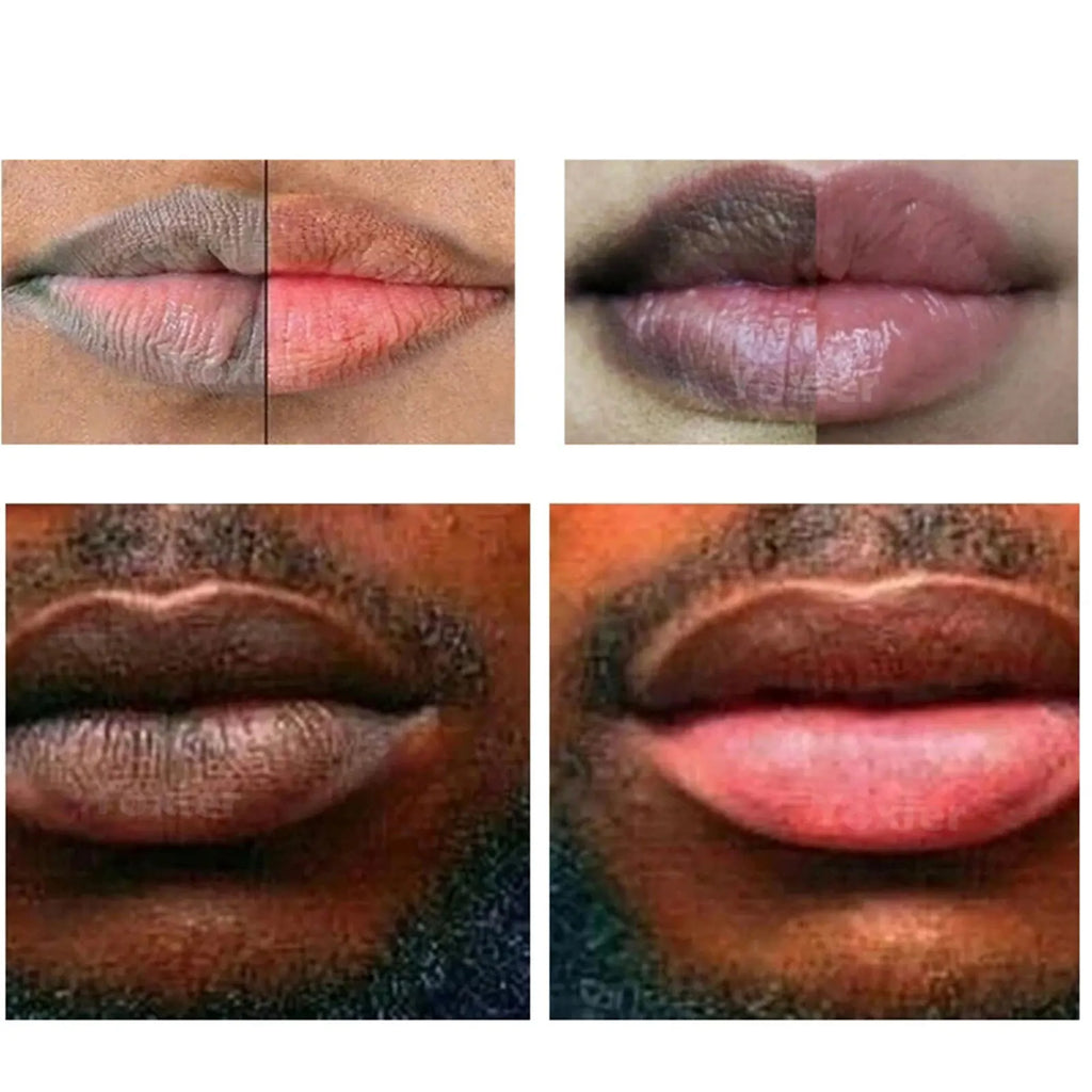 Dark Lip Scrub & Moisturizer for Smokers