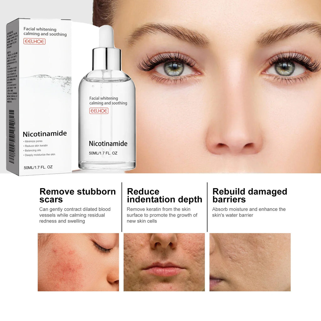 Niacinamide Brightening Face Serum — Pore Minimising & Oil Control (50ml–150ml)