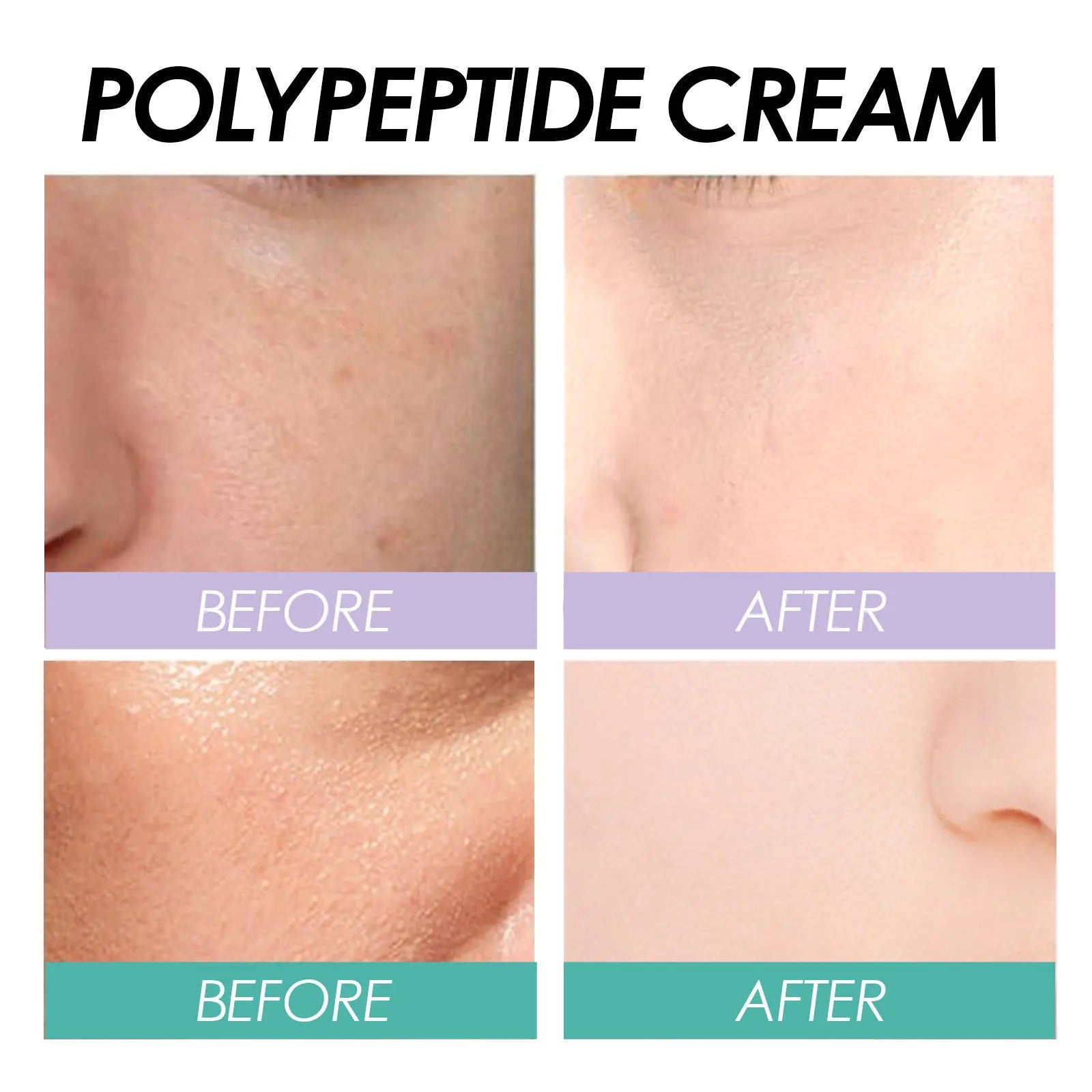 EELHOE Polypeptide Anti-Aging Moisturizer