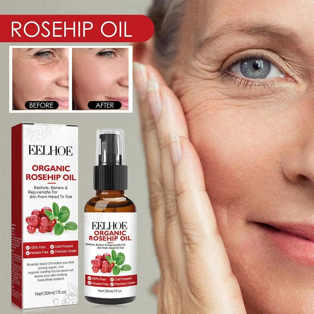 EELHOE Rosehip Serum