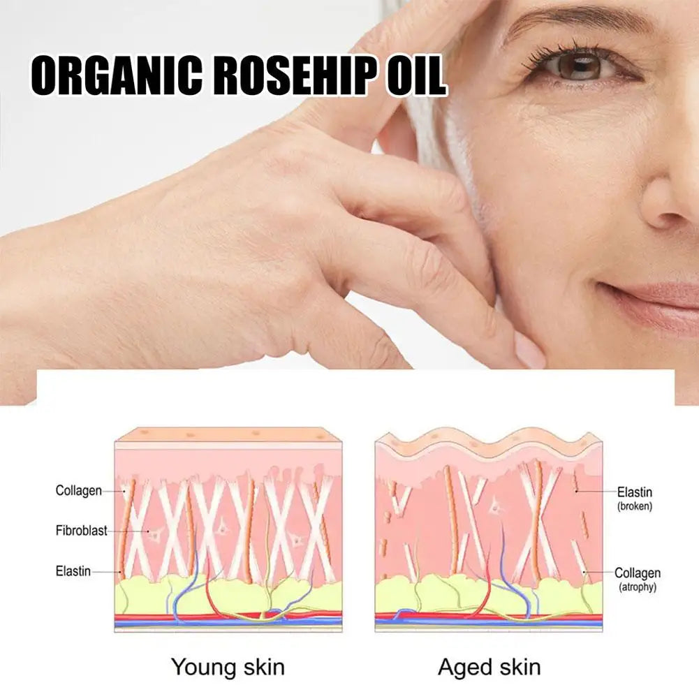 EELHOE Rosehip Serum