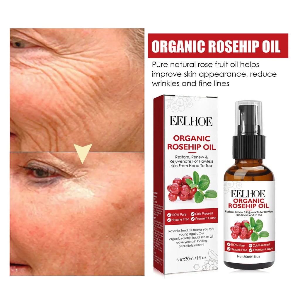 Rosehip Oil Anti-Ageing Face Serum — Deep Hydration, Wrinkle Reduction & Brightening (30ml)