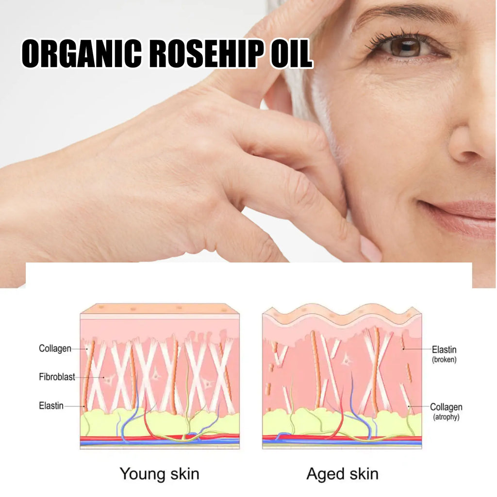 Rosehip Oil Anti-Ageing Face Serum — Deep Hydration, Wrinkle Reduction & Brightening (30ml)