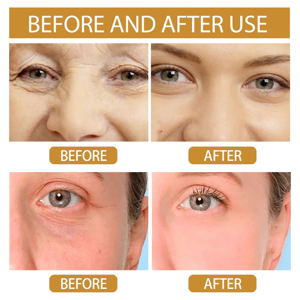 EELHOE Snail Serum
