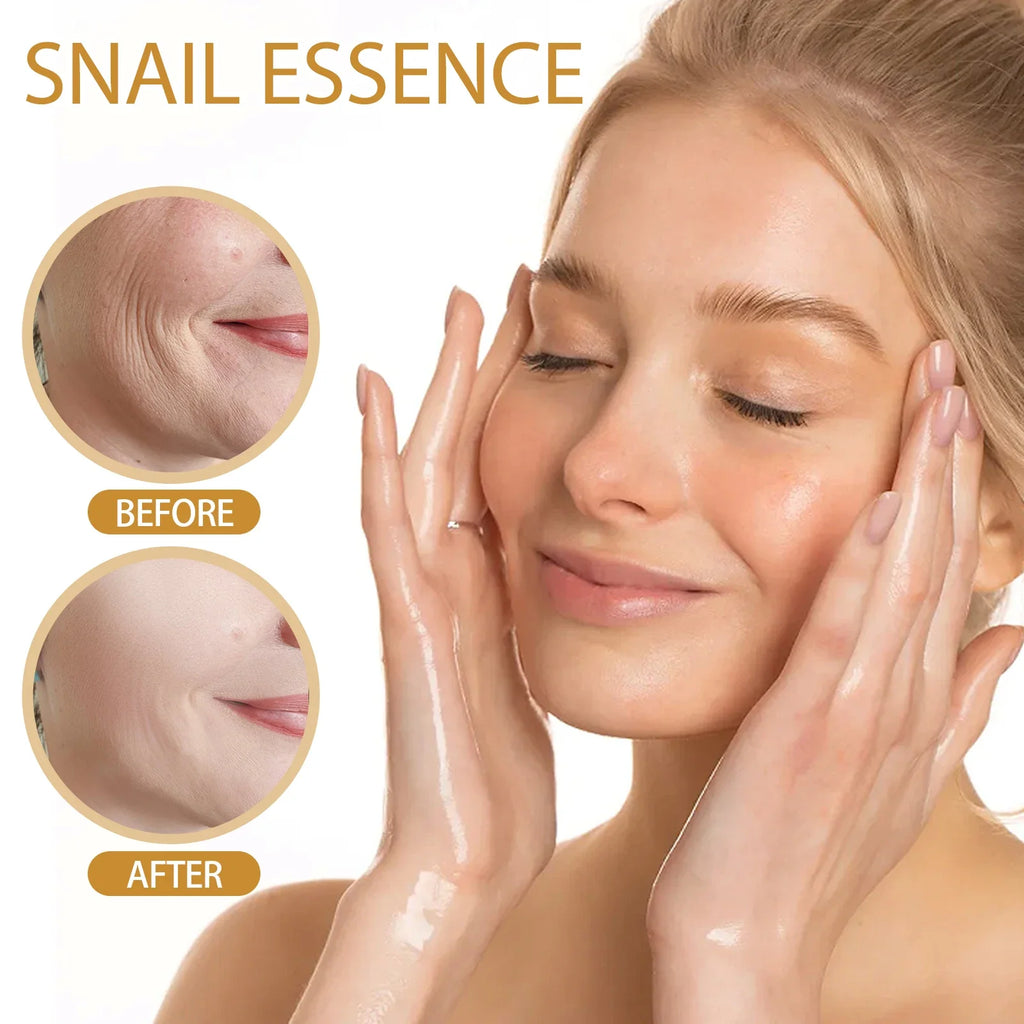 EELHOE Snail Serum