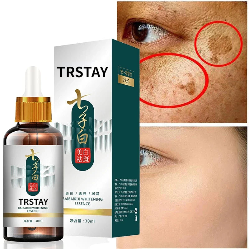 Dark Spot Brightening Serum — Fades Pigmentation, Freckles & Uneven Skin Tone (Natural Formula)