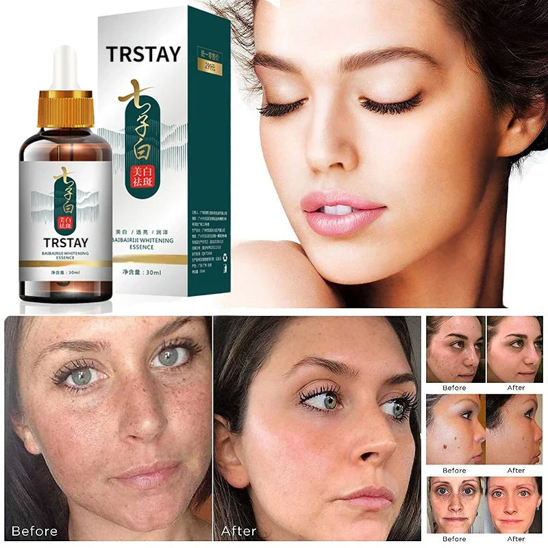 Dark Spot Brightening Serum — Fades Pigmentation, Freckles & Uneven Skin Tone (Natural Formula)