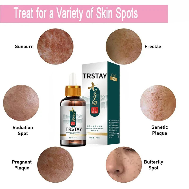 Dark Spot Brightening Serum — Fades Pigmentation, Freckles & Uneven Skin Tone (Natural Formula)