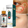 Dark Spot Brightening Serum — Fades Pigmentation, Freckles & Uneven Skin Tone (Natural Formula)