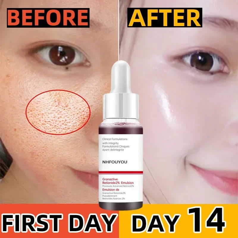 Deep Hydration Face Serum — Pore Minimising, Moisturising & Acne-Prone Skin (10ml)