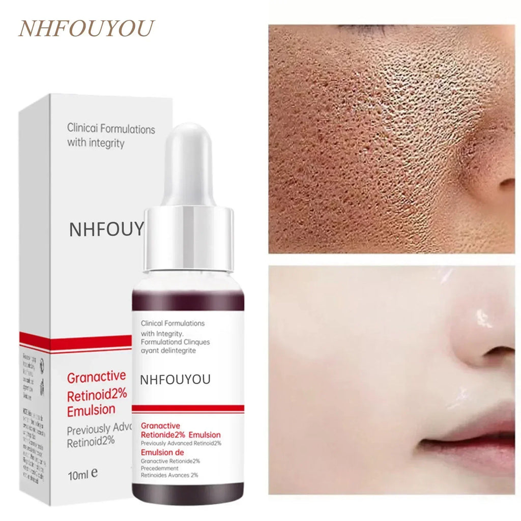 Deep Hydration Face Serum — Pore Minimising, Moisturising & Acne-Prone Skin (10ml)