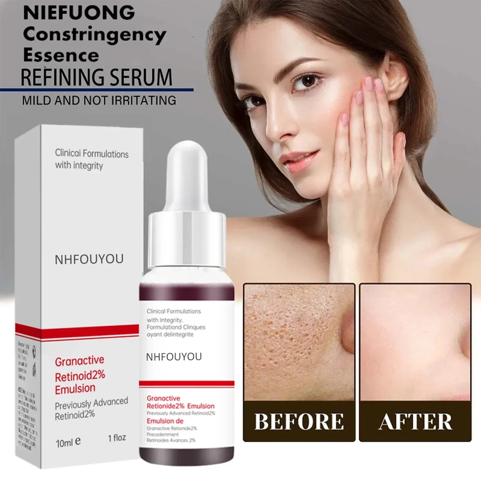 Deep Hydration Face Serum — Pore Minimising, Moisturising & Acne-Prone Skin (10ml)