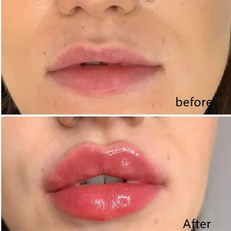 Lip Plumper Serum — Natural Plumping, Moisturising & Fine Line Reduction (Non-Sticky Gloss)