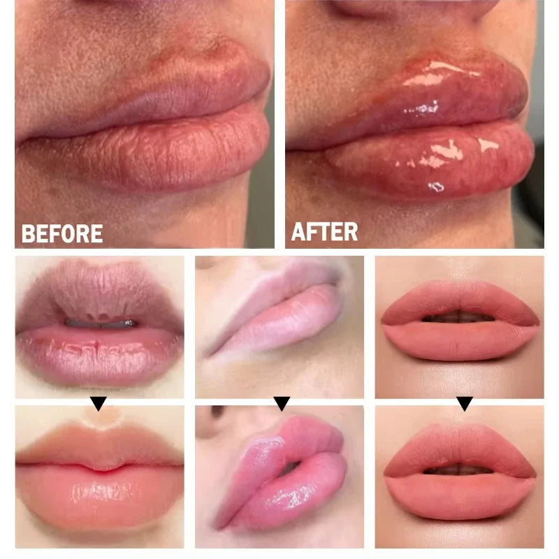 Lip Plumper Serum — Natural Plumping, Moisturising & Fine Line Reduction (Non-Sticky Gloss)