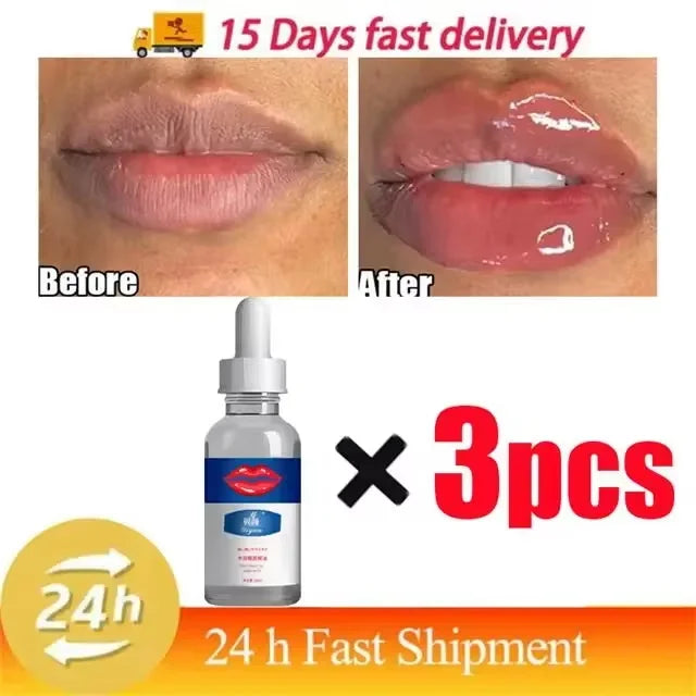 Lip Plumper Serum — Natural Plumping, Moisturising & Fine Line Reduction (Non-Sticky Gloss)