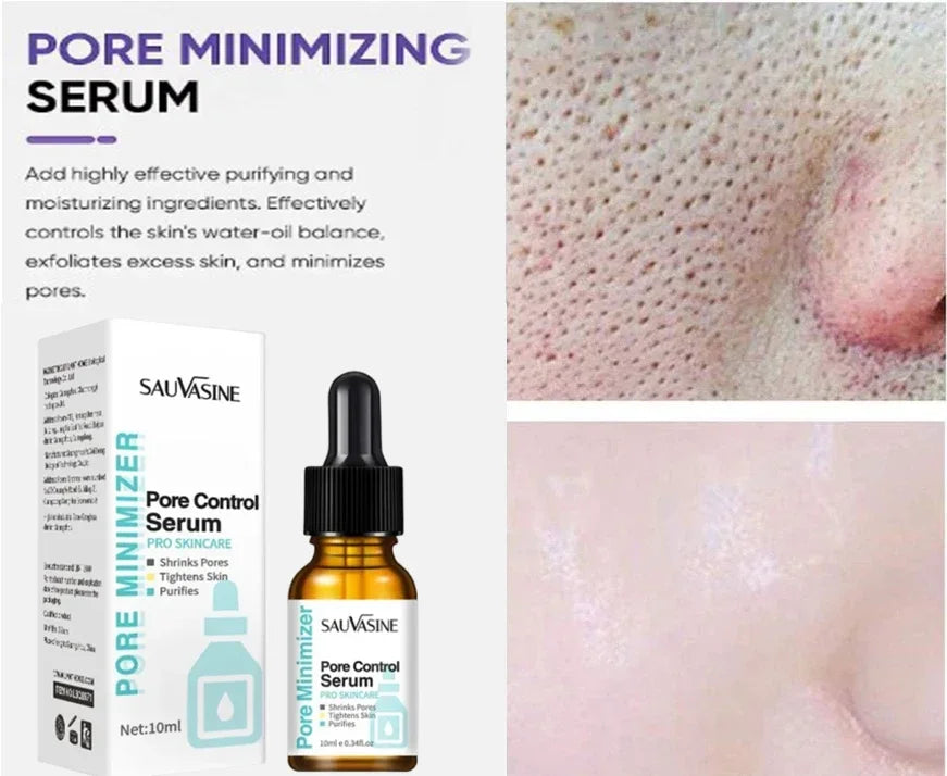Pore Minimising AHA Serum — Shrinks Pores, Treats Acne & Brightens Complexion (Lightweight, Non-Greasy)