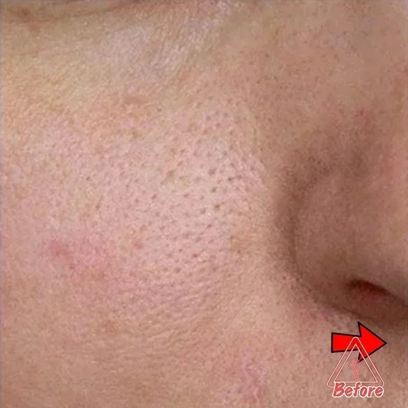 Pore Minimising AHA Serum — Shrinks Pores, Treats Acne & Brightens Complexion (Lightweight, Non-Greasy)