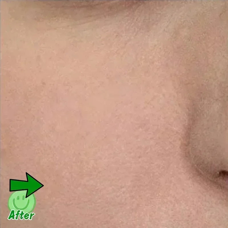 Pore Minimising AHA Serum — Shrinks Pores, Treats Acne & Brightens Complexion (Lightweight, Non-Greasy)