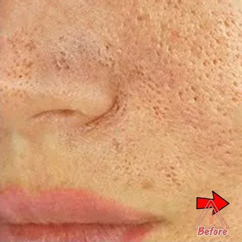 Pore Minimising AHA Serum — Shrinks Pores, Treats Acne & Brightens Complexion (Lightweight, Non-Greasy)