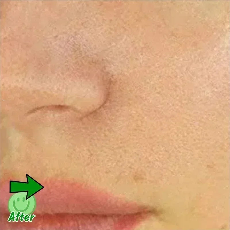 Pore Minimising AHA Serum — Shrinks Pores, Treats Acne & Brightens Complexion (Lightweight, Non-Greasy)