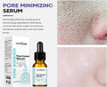 Pore Minimising AHA Serum — Shrinks Pores, Treats Acne & Brightens Complexion (Lightweight, Non-Greasy)