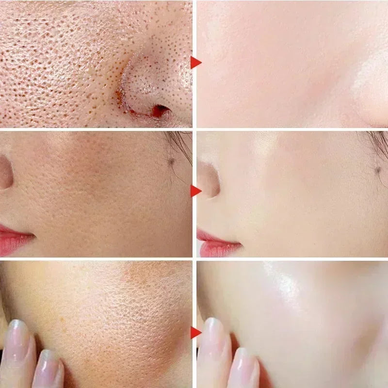 Pore Remover Serum